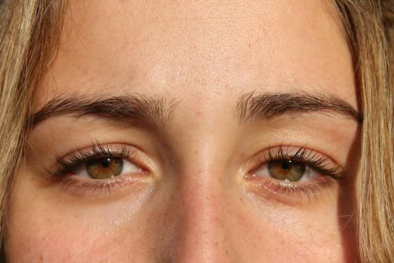 Why Does My Eyelashes Hurt