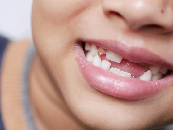 Do Gums Grow Back After Injury