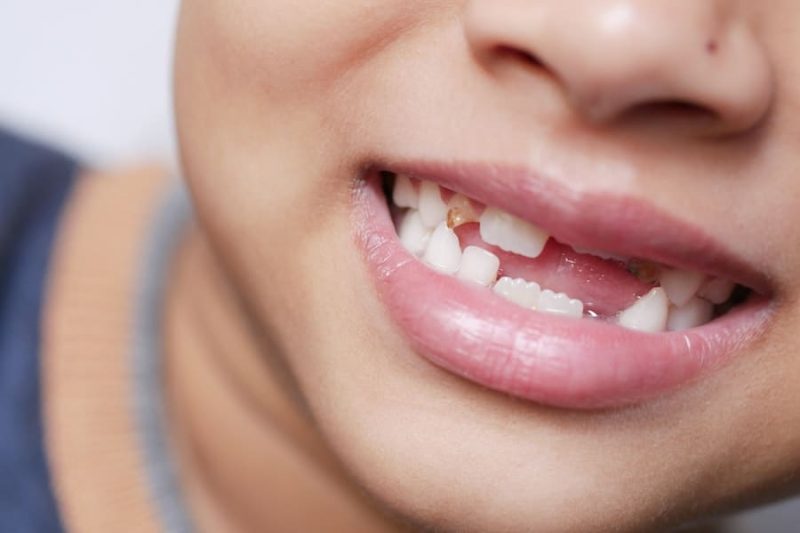 Do Gums Grow Back After Injury