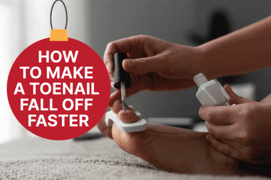 how-to-make-a-toenail-fall-off-faster-naturally-reader-ship