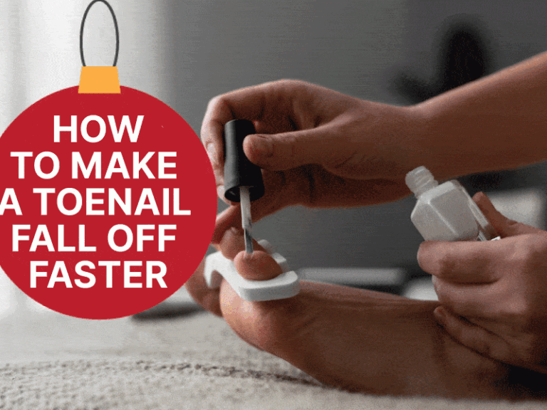 How To Make A Toenail Fall Off Faster