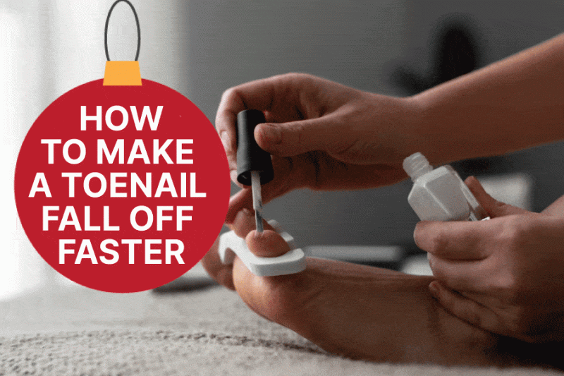 How To Make A Toenail Fall Off Faster