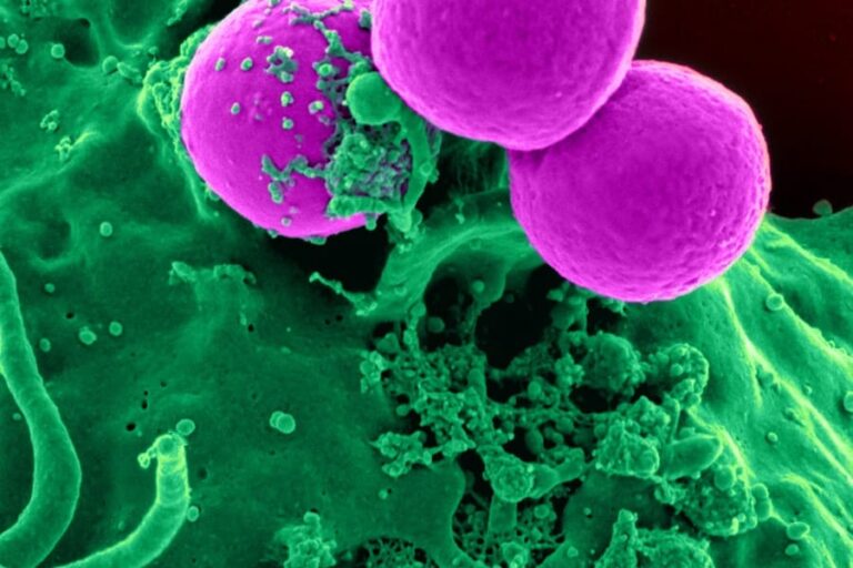 Can You Have A Uti And Yeast Infection At The Same Time? Unraveling The Mystery
