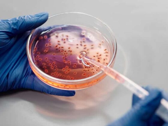 How Do You Increase Christensenella Bacteria